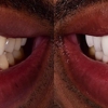 Asaro Dental Aesthetics gallery