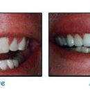 Wyse Family & Cosmetic Dentistry - Cosmetic Dentistry