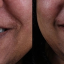 Peak Family Dentistry - Implant Dentistry