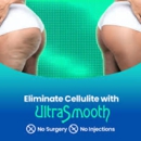 UltraSlim of Vancouver