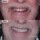 Michigan Dental Implant Studio - Implant Dentistry