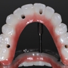 Florida Dental Implant Studio gallery