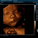 Baby Bee 3D Ultrasound (Fort Worth/NRH) - Medical Imaging Services