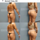 Bennett C. Yang, MD - Virginia Plastic Surgeon