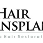 My Hair Transplant MD