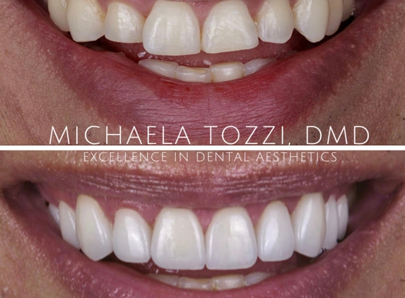 Dr. Michaela Tozzi, DMD: Cosmetic Dentistry & Dental Aesthetics - Henderson, NV