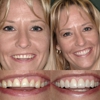 James B. Polley, DDS gallery
