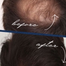 The Hair Loss Doctors - Surgery Centers