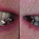 Smiles For Life Dental Care - Staunton - Dentists