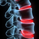 Triangle Spinal Decompression - Chiropractors & Chiropractic Services