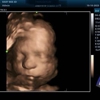 (Arlington) Baby Bee 3D Ultrasound + Studio gallery