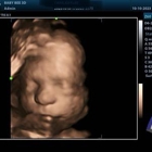 Baby Bee 3D Ultrasound (Fort Worth)
