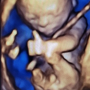 Love At First Sight 3D/4D Ultrasound Imaging Studio - Medical Imaging Services