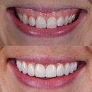 Dentistry of Lawrenceburg - Implant Dentistry