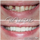 Just Smiles - General, Cosmetic & Implant Dentistry