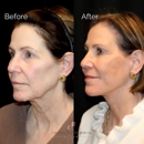 Lindsey Pennington, MD Facial Plastics